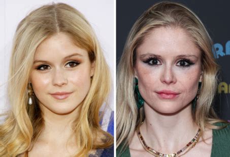 erin moriarty plastic|Starlight Actress Erin Moriartys Plastic Surgery。